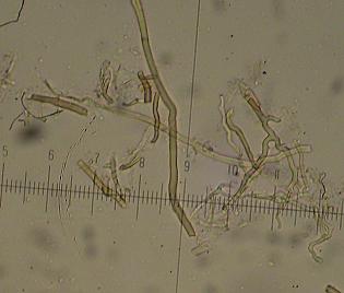 Coriolopsis gallica